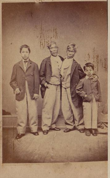 Ly kỳ đời sống của cặp song sinh dính liền thân vẫn lấy vợ, sinh tổng cộng 21 đứa con-6