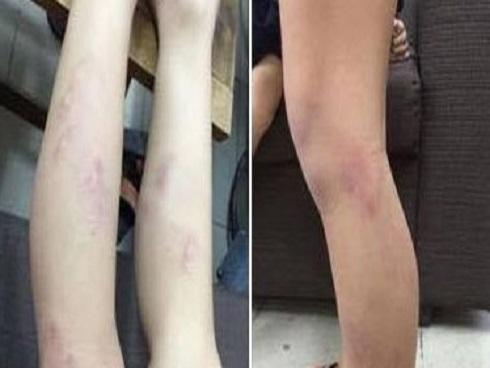 Kinh hoàng xe khách đâm trực diện container trên quốc lộ 18-3