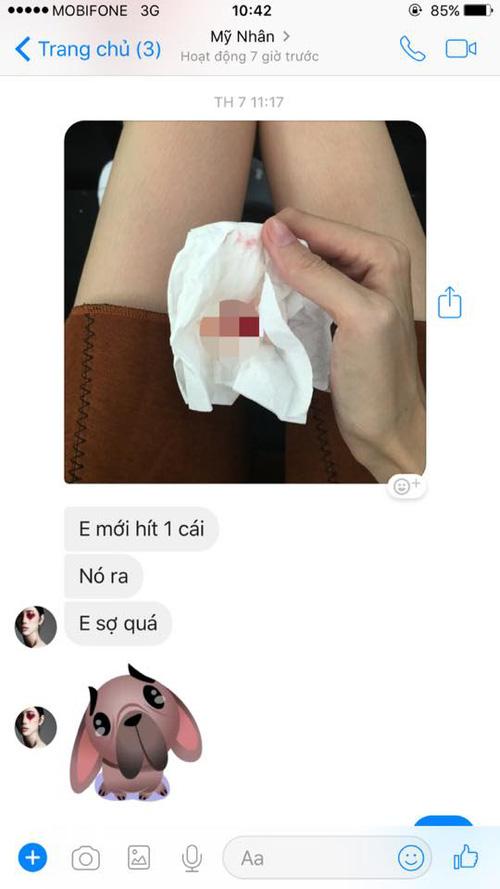 Cao Ngân nói gì khi cơ thể cao 1m78 nặng chưa đến 40kg của mình bị chê bai dữ dội?-2