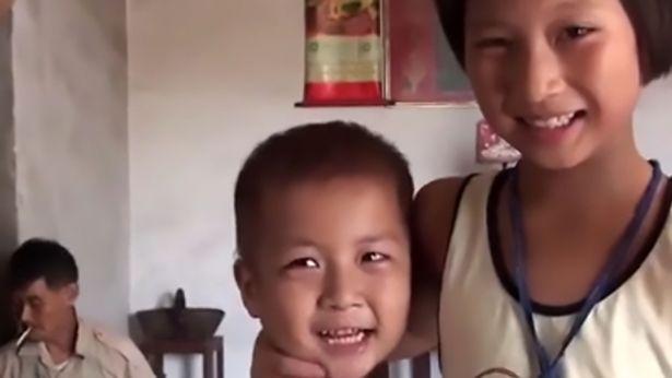 Khoảnh khắc bé trai 5 tuổi có bàn chân kỳ lạ bước đi khiến ai cũng xót xa-2