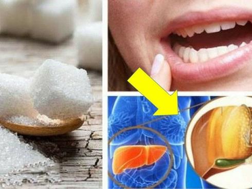 Bạn sẽ không ngờ những tác hại khi ăn nhiều đường lại nghiêm trọng thế này