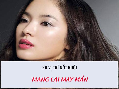 20 nốt ruồi mang lại may mắn, bạn đừng vì ham thẩm mỹ mà xóa bỏ