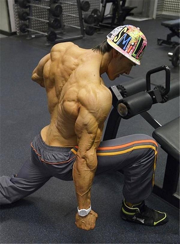 Choáng khi thấy người đàn ông 48 tuổi bị quắt hết mỡ cơ thể-2