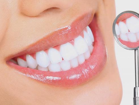 Cách tẩy trắng răng tại nhà hiệu quả-4