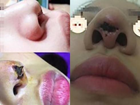 Sốc: Cô gái 27 tuổi phẫu thuật thẩm mỹ 200 lần vẫn chưa thỏa mãn cơn nghiện làm đẹp-6