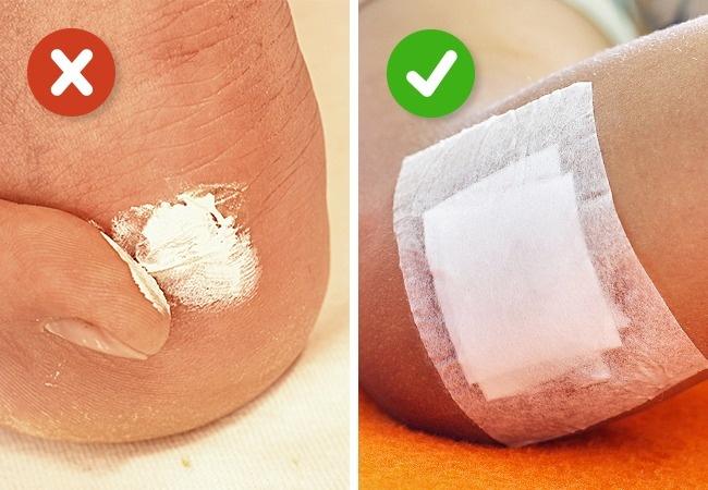 5 mẹo cứu thương tưởng thần thánh nhưng gây hại không ngờ-5