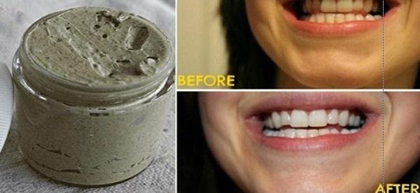 Tự chế kem đánh răng tự nhiên chữa sâu răng và làm trắng răng hiệu quả trong 1 nốt nhạc-1