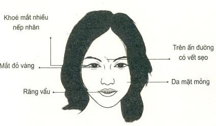 Tổng hợp tướng phụ nữ không xấu người thì xấu nết, ai yêu phải cũng khổ cực trăm bề-1