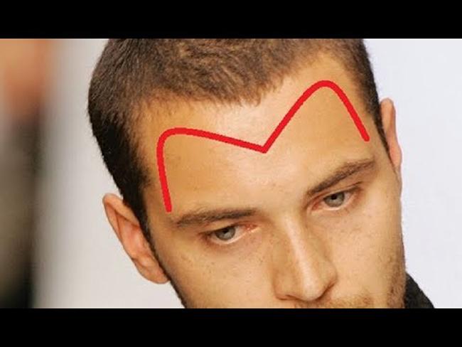 Mổ xẻ vận mệnh mỗi người bằng cách xem tướng vầng trán-2