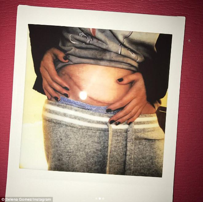 Nhan sắc nóng bỏng của cô bạn 8x sẵn sàng hiến thận cho Selena Gomez-2