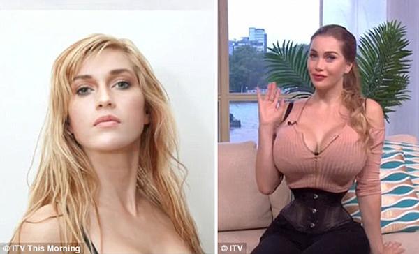 Sốc: Cô gái 27 tuổi phẫu thuật thẩm mỹ 200 lần vẫn chưa thỏa mãn cơn nghiện làm đẹp-1