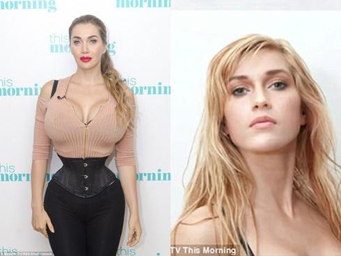 22 tuổi mà bị lão hóa như cụ bà 80, cô gái lột xác nhờ phẫu thuật thẩm mỹ-8