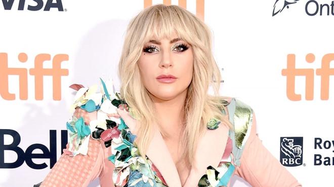 Lady Gaga hoãn lưu diễn châu Âu vì những cơn đau nghiêm trọng-1