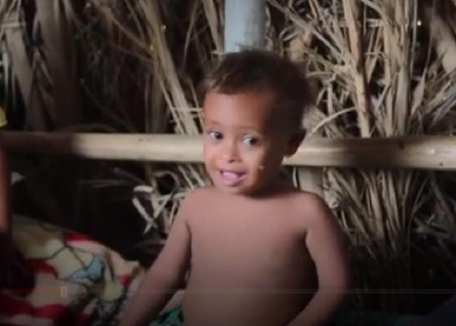 Cậu bé da bọc xương thoi thóp chờ chết gây chấn động thế giới 1 năm trước giờ ra sao?-4