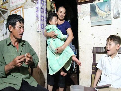 Bé 3 tuổi chảy máu mũi do nghịch dại với cục pin-2