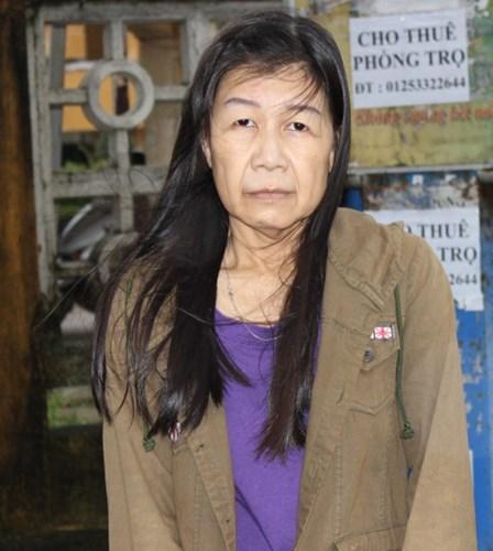 22 tuổi mà bị lão hóa như cụ bà 80, cô gái lột xác nhờ phẫu thuật thẩm mỹ-2