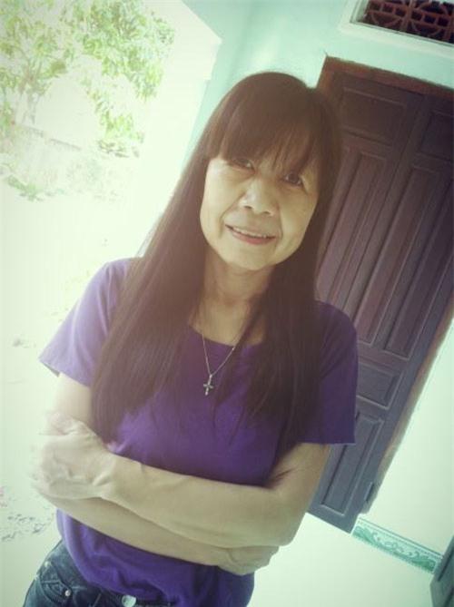 22 tuổi mà bị lão hóa như cụ bà 80, cô gái lột xác nhờ phẫu thuật thẩm mỹ-3