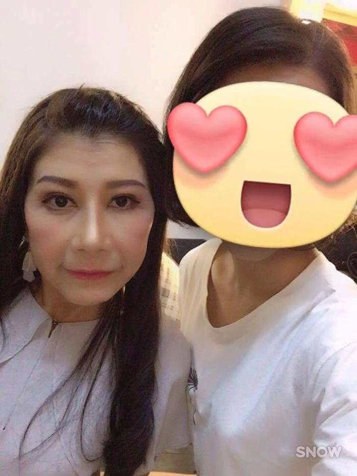 22 tuổi mà bị lão hóa như cụ bà 80, cô gái lột xác nhờ phẫu thuật thẩm mỹ-6