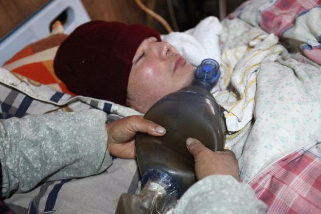 Bố mẹ ngày đêm bóp bóng thở suốt 5 năm trời giúp con duy trì sự sống, dừng lại 3 phút con sẽ chết-1