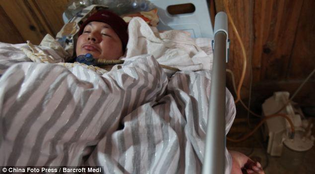 Bố mẹ ngày đêm bóp bóng thở suốt 5 năm trời giúp con duy trì sự sống, dừng lại 3 phút con sẽ chết-4