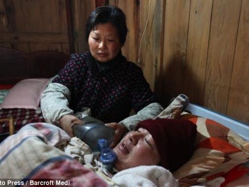 Bố mẹ ngày đêm bóp bóng thở suốt 5 năm trời giúp con duy trì sự sống, dừng lại 3 phút con sẽ chết