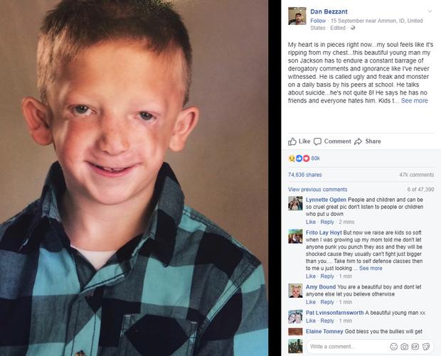 Con trai bị bắt nạt và gọi là đồ xấu xí ở trường, ông bố gửi tâm thư cảm động trên Facebook-2