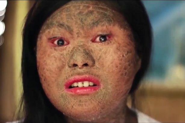 Những người mắc bệnh lạ đến y học cũng phải bó tay chữa không nổi-1