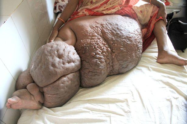 Những người mắc bệnh lạ đến y học cũng phải bó tay chữa không nổi-4