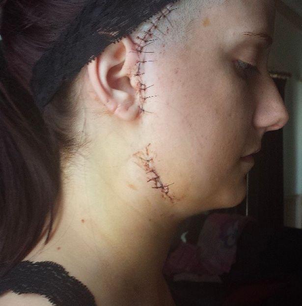 Những người mắc bệnh lạ đến y học cũng phải bó tay chữa không nổi-6