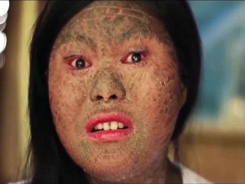 Bé trai 8 tuổi ở Hà Nội mắc bệnh lạ: Cứ ngóc đầu lên là ngất xỉu-6