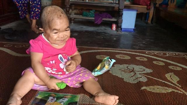 Kỳ lạ người phụ nữ 27 tuổi mang hình hài trẻ lên 2 ở Thái Nguyên-1