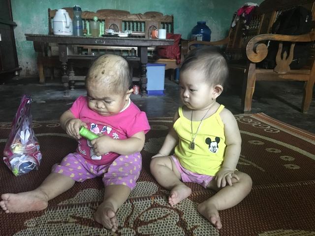 Kỳ lạ người phụ nữ 27 tuổi mang hình hài trẻ lên 2 ở Thái Nguyên-2