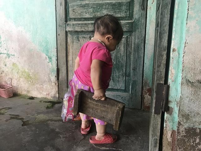 Kỳ lạ người phụ nữ 27 tuổi mang hình hài trẻ lên 2 ở Thái Nguyên-3