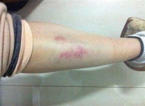 Dương Mịch, Lâm Tâm Như từng là nạn nhân của bạo lực phim trường-9