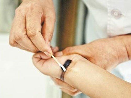 Bé trai 10 tuổi bôi mực vào tay, che giấu bệnh để bố mẹ không phải khổ-2