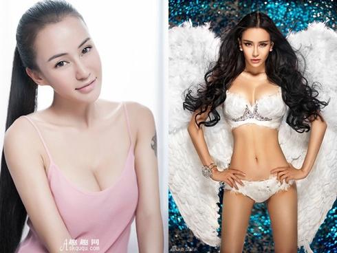 Phẫu thuật kéo dài chân như thế nào?-1