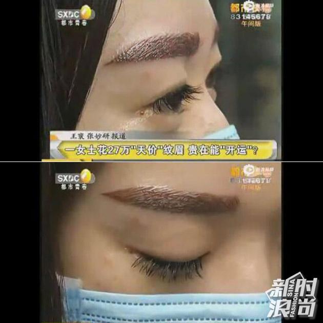 Chi 92 tỷ để làm lông mày, và đây là đôi lông mày người phụ nữ này nhận được-1