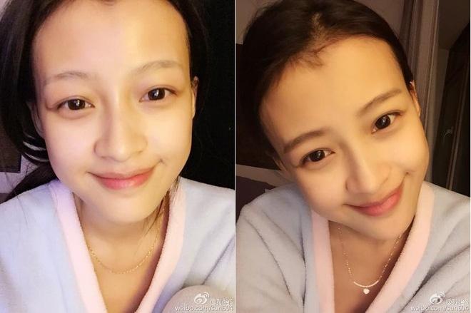 Chi 92 tỷ để làm lông mày, và đây là đôi lông mày người phụ nữ này nhận được-2