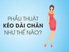 Phẫu thuật kéo dài chân như thế nào?