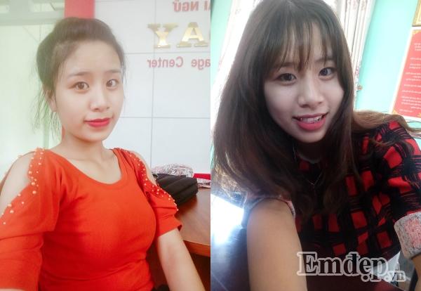 Mặt chi chít mụn cũng sạch bay, da mịn màng, căng bóng nhờ phương pháp đơn giản của nàng 9x-2