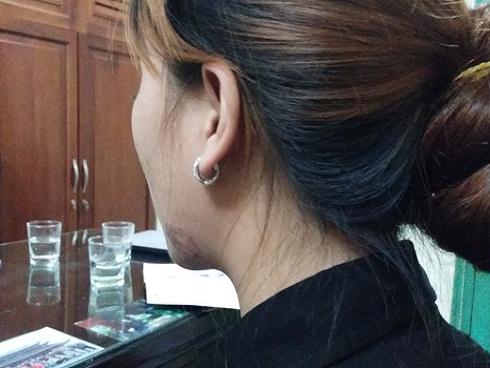 Vụ cô gái bị lột áo trên phố Hàng Mã: 'Tôi ân hận vì để xảy ra xô xát'