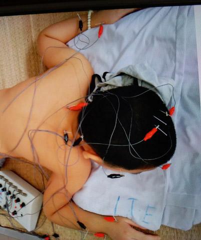 Bé trai 8 tuổi ở Hà Nội mắc bệnh lạ: Cứ ngóc đầu lên là ngất xỉu-4