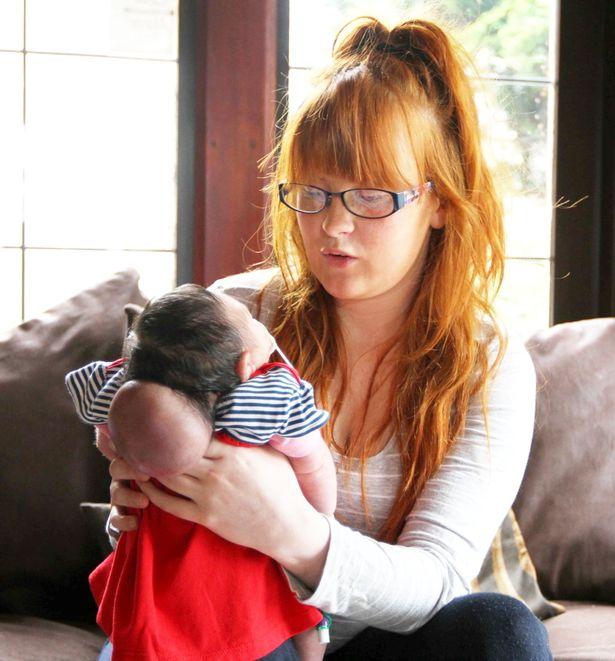 Khoảnh khắc bé gái có bộ não bên ngoài hộp sọ qua đời trong vòng tay mẹ khiến ai cũng nhói lòng-1