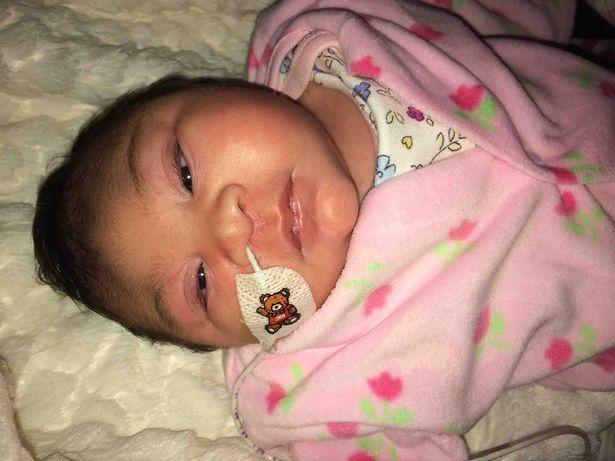 Khoảnh khắc bé gái có bộ não bên ngoài hộp sọ qua đời trong vòng tay mẹ khiến ai cũng nhói lòng-3