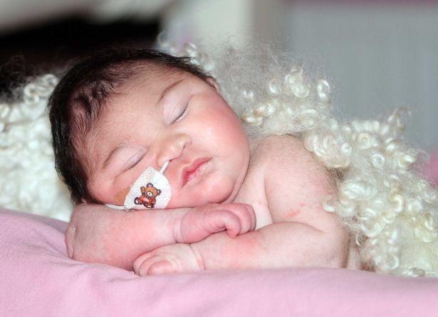 Khoảnh khắc bé gái có bộ não bên ngoài hộp sọ qua đời trong vòng tay mẹ khiến ai cũng nhói lòng-4