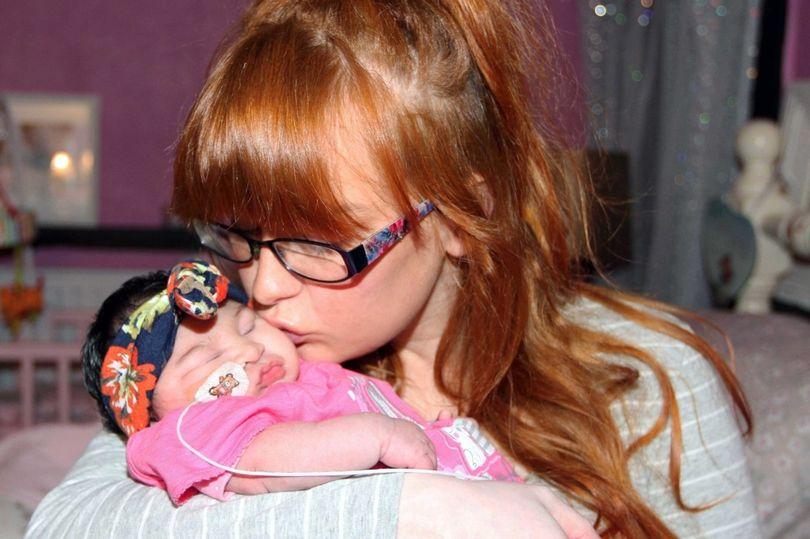 Khoảnh khắc bé gái có bộ não bên ngoài hộp sọ qua đời trong vòng tay mẹ khiến ai cũng nhói lòng-5