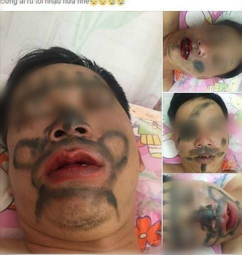 Hốt hoảng với những cách trừng trị chồng say xỉn của các bà vợ có tâm-4