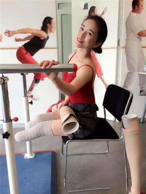 Cuộc đời đầy bão giông của vũ công xinh đẹp: Mất con, mất cả đôi chân rồi còn bị chồng bỏ rơi-9
