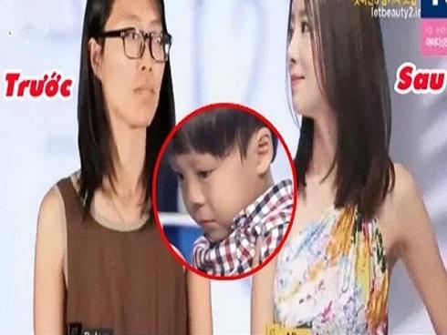 Những câu chuyện phẫu thuật thẩm mỹ khóc dở mếu dở: Con không nhận ra mẹ, chồng chẳng nhìn ra vợ