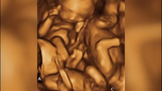 Chửa trâu 10 tháng chưa đẻ, gia đình bàng hoàng khi phát hiện bí mật đen tối của cô con gái tuổi teen-4